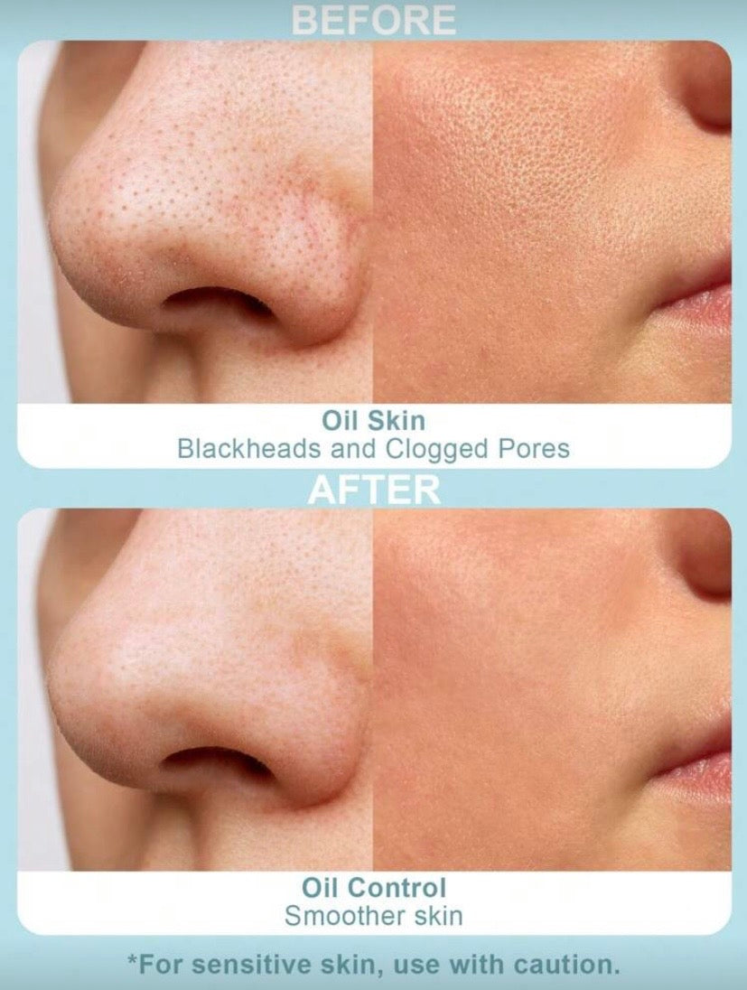 Masque Moussant au Charbon Purifiant